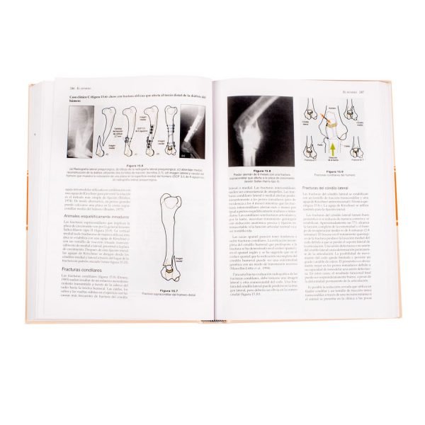 Manual de Reparación y Tratamiento de Fracturas - Imagen 3
