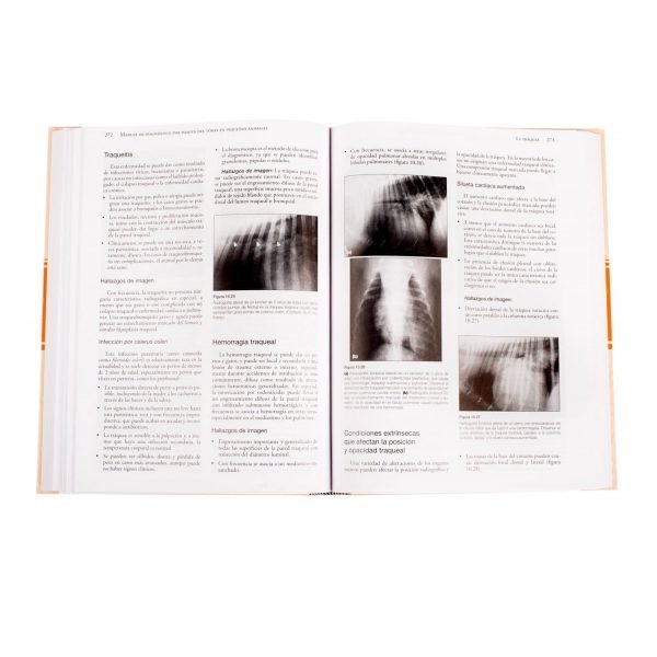 Manual de Diagnóstico por Imagen del Tórax - Imagen 4