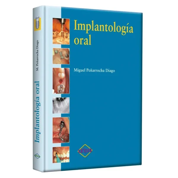 Libro Implantología Oral