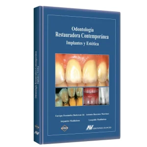 Libro Odontología Restauradora Contemporánea